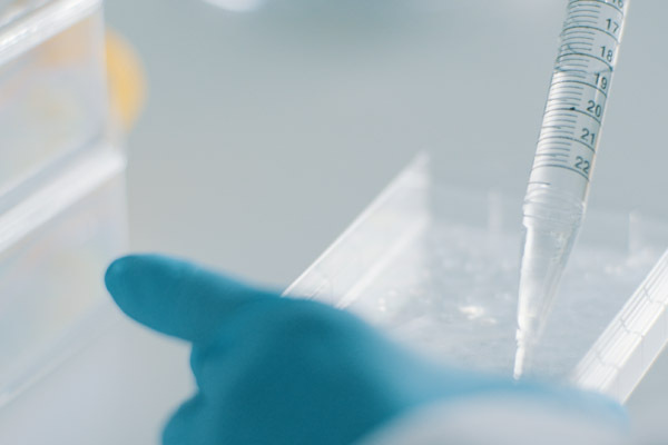 Mittel werden für die Forschung um autologe Hautransplantation bereitgestellt