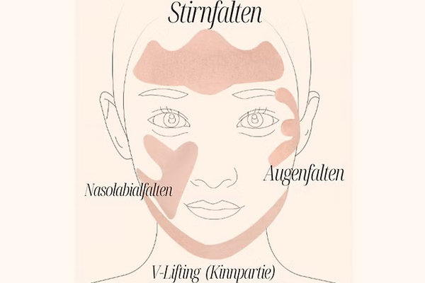 Passgenaue Face Tapes für die individuellen Gesichtszonen